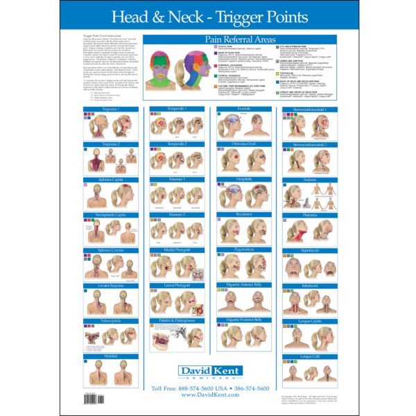 Trigger Point Wall Chart